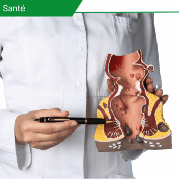 Cancer colorectal, du rectum versus de l’anus